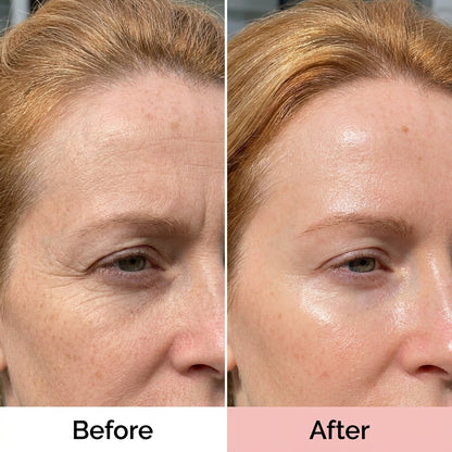 PDRN Collagen Glow Balm